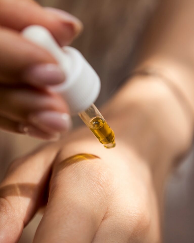 how to prevent winter eczema